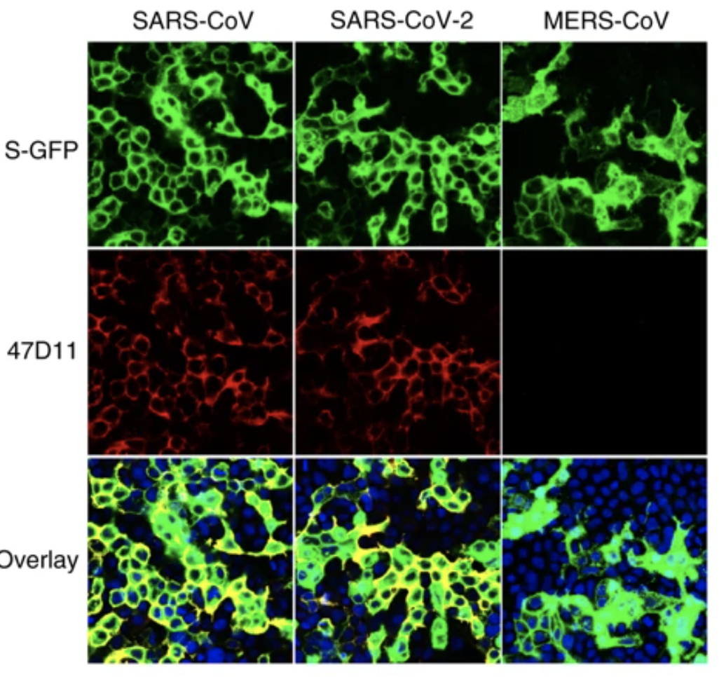 A human monoclonal antibody blocks SARS-CoV-2 in cell culture