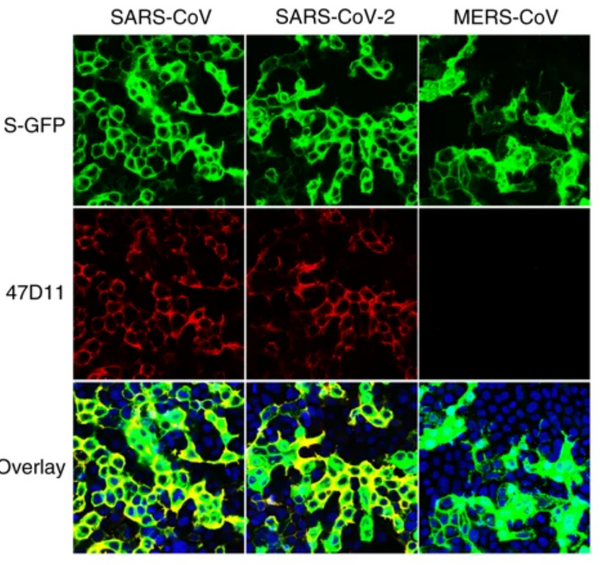 A human monoclonal antibody blocks SARS-CoV-2 in cell culture